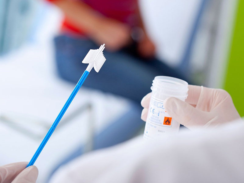 Xét nghiệm tế bào học bằng phương pháp Liqui Prep